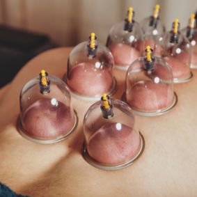 cupping-therapy-center-in-dehradun